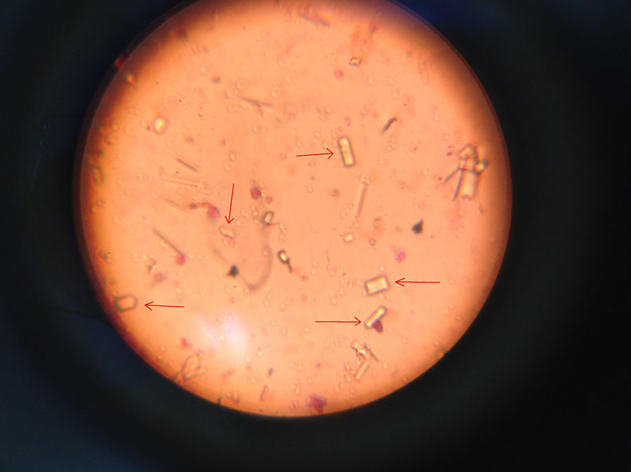 Urinalysis